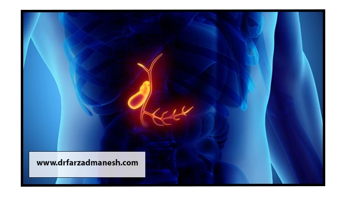 مراقبت‌های بعد از جراحی لاپاراسکوپی کیسه صفرا شامل چه مواردی می‌شود؟