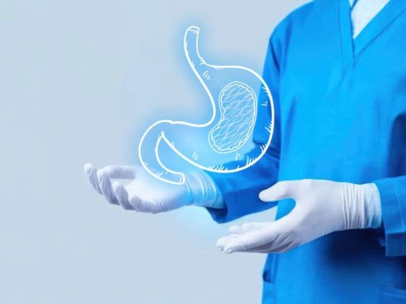 اسلیو معده بعد از زایمان؛ انتخاب هوشمندانه برای زیبایی و سلامت